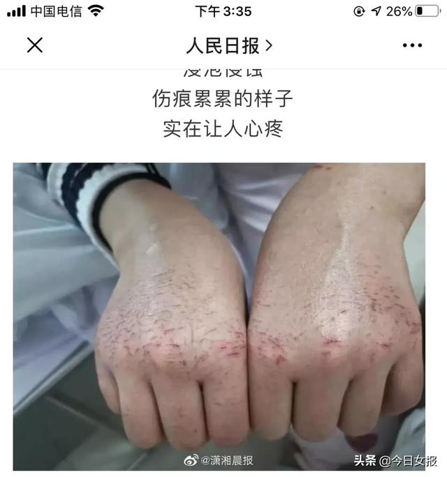 为什么说在这次武汉新型肺炎面前，才算看清了湖南人的“真面目”？