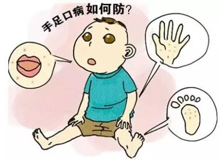手足口病已进入高发季，省疾控发布预防“秘籍”
