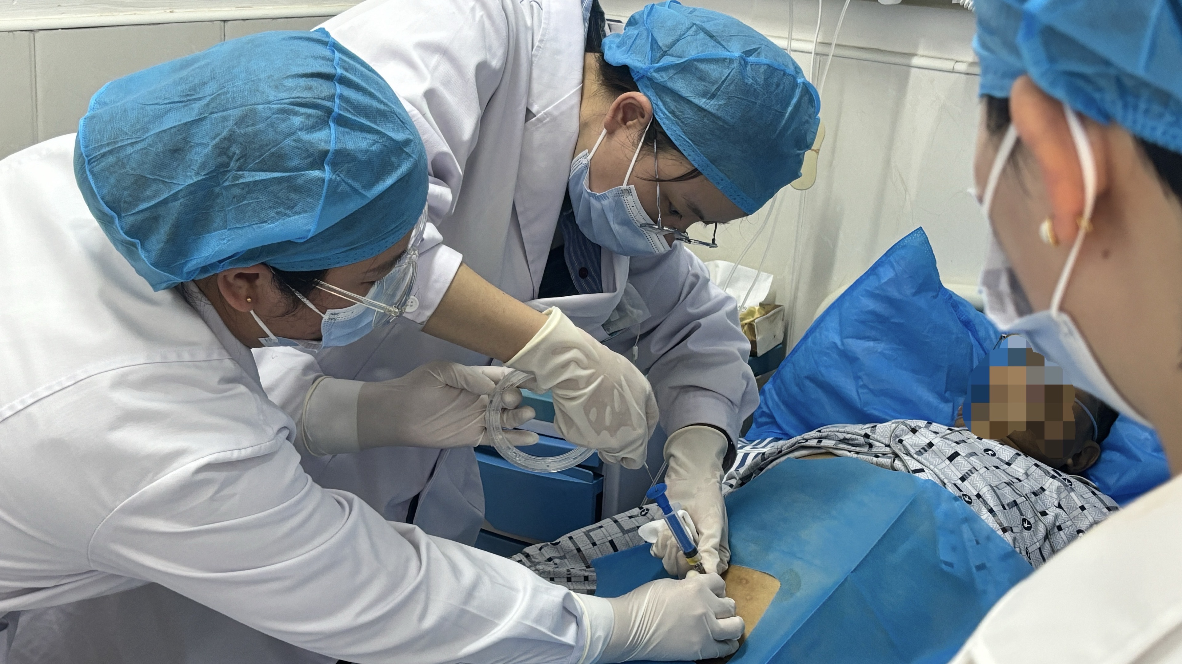 长城乡卫生院综合内科：打破偏见，精准腹腔穿刺在基层